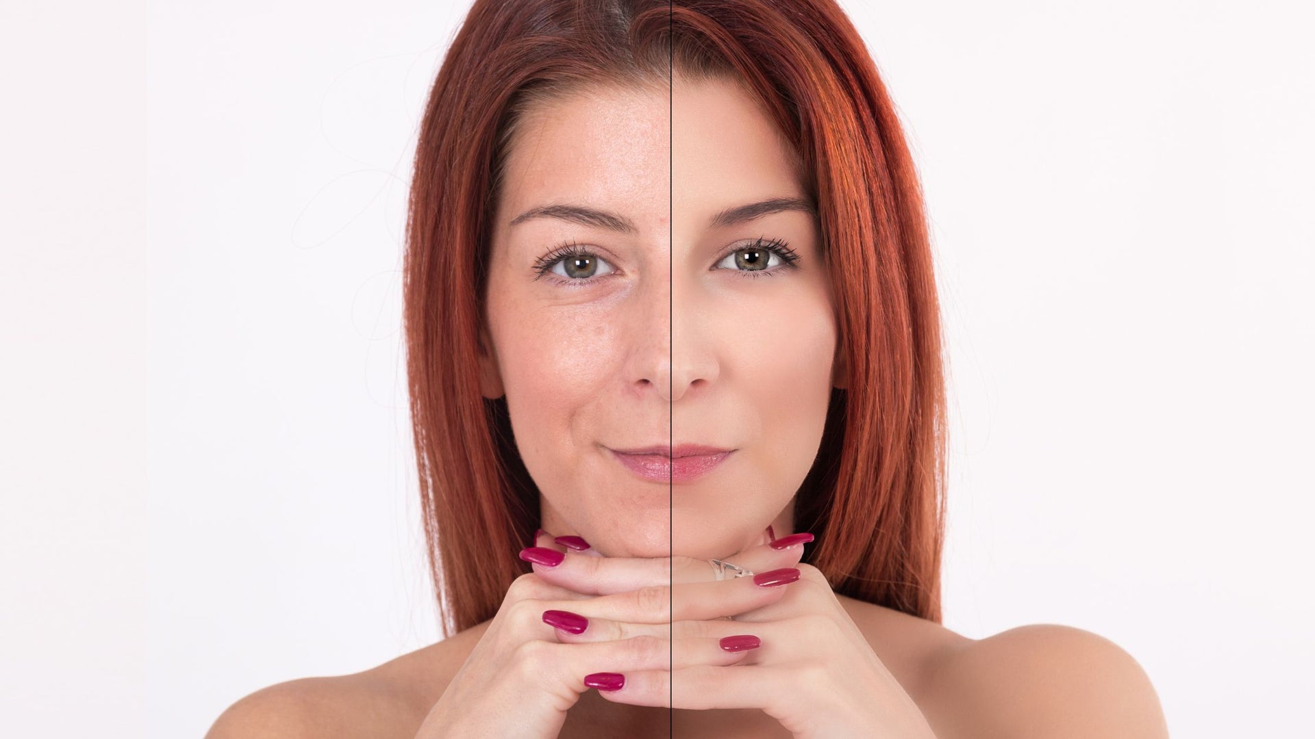 Gelixer Collagen